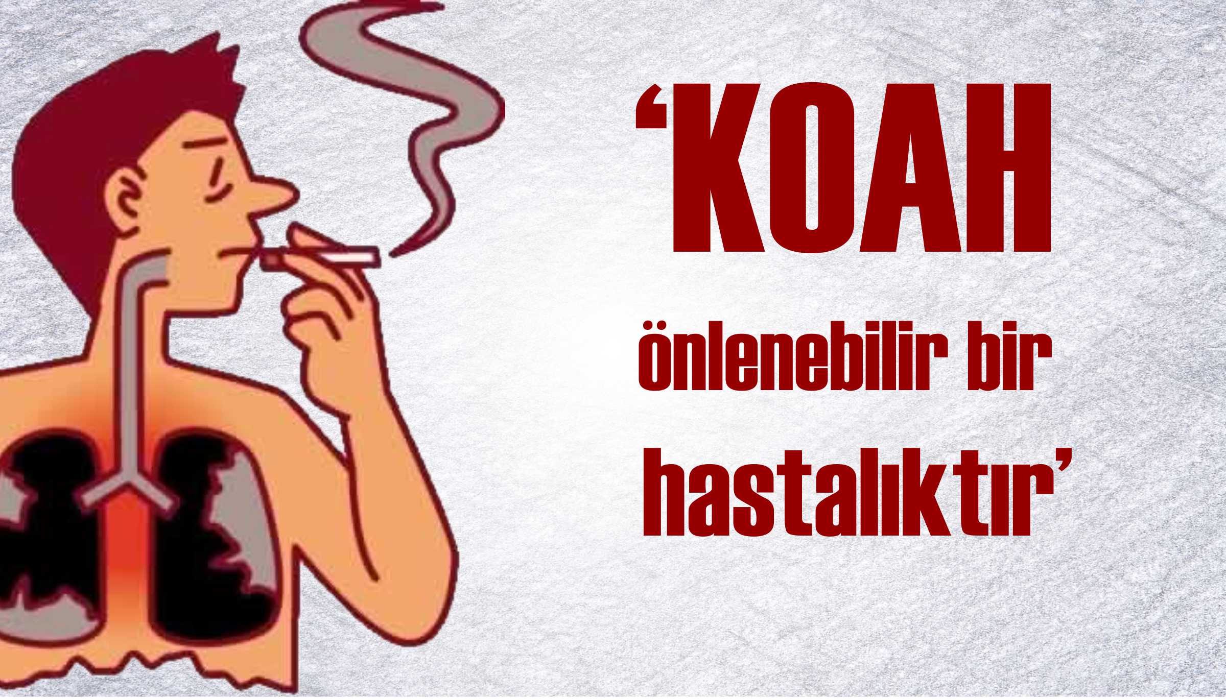 KOAH Hastalığına Bitkisel Çözüm iyi Gelen Bitkiler KOAH Hastalığına Bitkisel Çözüm iyi Gelen Bitkiler