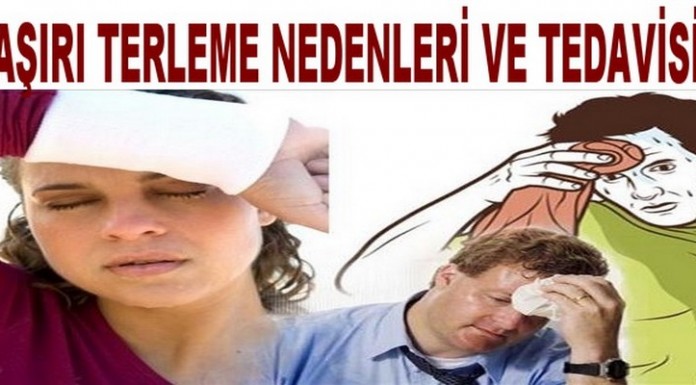 Aşırı Terleme Nedir?