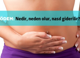 Ödem Nedir?