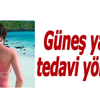 Birinci derece ve ikinci derece güneş yanığı arasındaki fark nedir? Nasıl tedavi edilir? Güneş yanığı sonrasında kaşıntıyı önlemek için ne