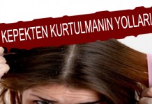 Kepek Neden Olur? Kepek Neden Olur?