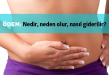 Ödem Nedir?