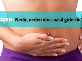 Ödem Nedir?