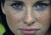 İbrahim Saraçoğlu Çil Tedavisi